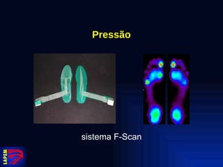 Pressão sistema F-Scan 