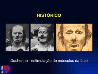 HISTÓRICO Duchenne - estimulação de músculos da face 