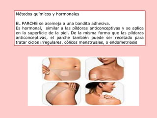 Métodos químicos y hormonales
EL PARCHE se asemeja a una bandita adhesiva.
Es hormonal, similar a las píldoras anticonceptivas y se aplica
en la superficie de la piel. De la misma forma que las píldoras
anticonceptivas, el parche también puede ser recetado para
tratar ciclos irregulares, cólicos menstruales, o endometriosis
 
