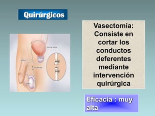 Quirúrgicos
                Vasectomía:
                 Consiste en
                  cortar los
                 conductos
                 deferentes
                  mediante
                intervención
                  quirúrgica

              Eficacia : muy
              alta
 
