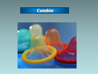 Condón
 