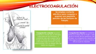 Se emplea corriente 
eléctrica para coagular o 
quemar una pequeña 
porción de las trompas de 
Falopio. 
Coagulación unipolar se pasa 
corriente a través de un fórceps 
colocado en las trompas, la 
corriente sale del cuerpo de la 
mujer a través de un electrodo 
colocado bajo el muslo. (se ha 
relacionado con un riesgo alto de 
lesión en órganos. 
Coagulación bipolar la corriente 
entra al cuerpo de la mujer y sale 
de él a través de los extremos del 
fórceps. La coagulación bipolar es 
más segura pero un poco menos 
eficaz que la unipolar. 
 