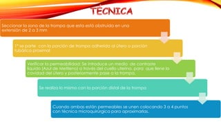 Seccionar la zona de la trompa que esta está obstruida en una 
extensión de 2 a 3 mm 
1° se parte con la porción de trompa adherida al útero o porción 
tubárica proximal 
Verificar la permeabilidad: Se introduce un medio de contraste 
líquido (Azul de Metileno) a través del cuello uterino, para que llene la 
cavidad del útero y posteriormente pase a la trompa. 
Se realiza lo mismo con la porción distal de la trompa 
Cuando ambas están permeables se unen colocando 3 a 4 puntos 
con técnica microquirúrgica para aproximarlas. 
 