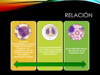 RELACIÓN
Procesos
tóxicoalérgicos, como la
nefritis intersticial por
fármacos, enf.
parasitarias, en una
amplia variedad de
nefropatías e
infecciones urinarias.
Y muy recientemente en
casi el 50% de pacientes
con enfermedad renal
ateroembólica
Es un indicador precoz
del rechazo en el
trasplante renal
 