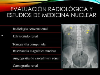 EVALUACIÓN RADIOLÓGICA Y
ESTUDIOS DE MEDICINA NUCLEAR
.
Radiología convencional
Ultrasonido renal
Tomografia computada
Resonancia magnética nuclear
Angiografia de vasculatura renal
Gamagrafia renal
 
