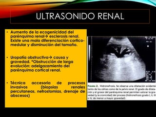 ULTRASONIDO RENAL
• Aumento de la ecogenicidad del
parénquima renal esclerosis renal.
Existe una mala diferenciación cortico-
medular y disminución del tamaño.
• Uropatía obstructiva causa y
gravedad. *Obstrucción de larga
evolución: adelgazamiento del
parénquima cortical renal.
• Técnica accesoria de procesos
invasivos (biopsias renales
percutaneas, nefrostomias, drenaje de
abscesos)
 