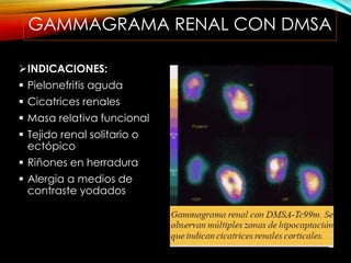 GAMMAGRAMA RENAL CON DMSA
INDICACIONES:
 Pielonefritis aguda
 Cicatrices renales
 Masa relativa funcional
 Tejido renal solitario o
ectópico
 Riñones en herradura
 Alergia a medios de
contraste yodados
 