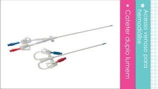 Cateterduplolumem
Acessovenosopara
hemodiálise
 