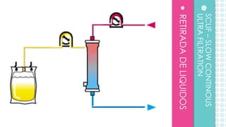 RETIRADADELIQUIDOS
SCUF–SLOWCONTINOUS
ULTRAFILTRATION
 