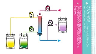 Retiradadelíquidos,diálise,
instabilidadehemodinâmicae
Sepse.
CVVHDF–Hemodiafiltração
veno-venosacontínua
 