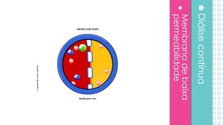 Membranadebaixa
permeabilidade
Diálisecontínua
 