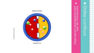 Membranadealta
permeabilidade(acrilonitrilo)
Diálisecontínua
 