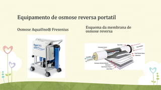 Equipamento de osmose reversa portatil
Osmose AquaUno® Fresenius
Esquema da membrana de
osmose reversa
 