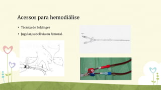 Acessos para hemodiálise
• Técnica de Seldinger
• Jugular, subclávia ou femoral.
 