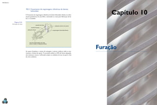 MECÂNICA 5




                                   9.8.2 Fresamento de engrenagens cilíndricas de dentes
                                         helicoidais
                                   O fresamento de engrenagens cilíndricas de dentes helicoidais obedece às infor-
                                   mações geométricas de uma hélice, montando-se a mesa para fabricação da hé-
                                                                                                                          Capítulo 10
                                   lice e o recâmbio.

                 Figura 9.41
             inclinação da mesa.
                                                     mandril da fresa
                                                                                     cabeçote móvel com ponto
                                            mandril da peça

                                      cabeçote divisor                           engrenagem helicoidal direita




                                         trem de engrenagem da viola,
                                         entre a mesa e o cabeçote divisor




                                   Ao operar fresadoras e centros de usinagem, é preciso conhecer todos os mo-
                                                                                                                     Furação
                                   vimentos e formas de operar. É necessário utilizar os EPIs de forma adequada,
                                   não manusear cavacos, verificando sempre as condições de uso em geral, a fim
                                   de evitar acidentes.




  280
 