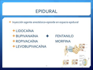 EPIDURAL Inyección agente anestésico+opioide en espacio epidural LIDOCAÍNA BUPIVANAÍNA ✚ FENTANILO ROPIVACAÍNA MORFINA LEVOBUPIVACAÍNA Métodos farmacológicos alivio dolor 