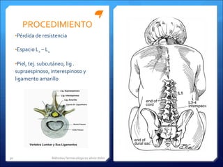PROCEDIMIENTO Pérdida de resistencia Espacio L 2  – L 4 Piel, tej. subcutáneo, lig . supraespinoso, interespinoso y ligamento amarillo Métodos farmacológicos alivio dolor 