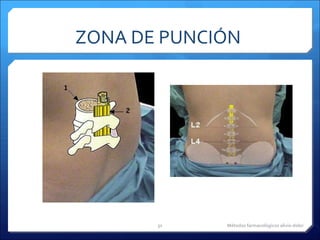 ZONA DE PUNCIÓN  Métodos farmacológicos alivio dolor 