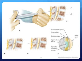 Métodos farmacológicos alivio dolor 