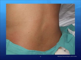 Métodos farmacológicos alivio dolor 