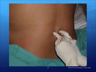 Métodos farmacológicos alivio dolor 