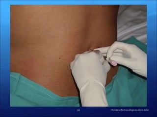 Métodos farmacológicos alivio dolor 