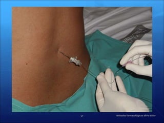 Métodos farmacológicos alivio dolor 