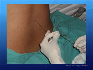 Métodos farmacológicos alivio dolor 