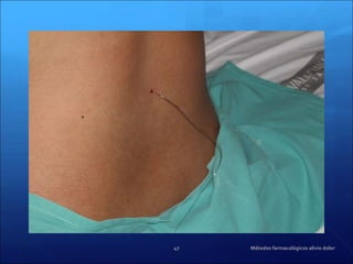 Métodos farmacológicos alivio dolor 