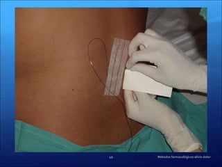 Métodos farmacológicos alivio dolor 