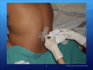 Métodos farmacológicos alivio dolor 