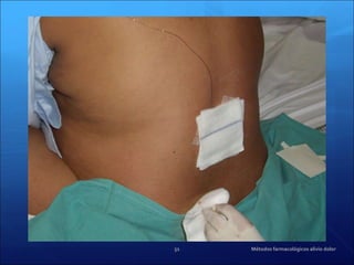 Métodos farmacológicos alivio dolor 