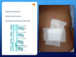Apósito de fijación Bolos intermitentes Perfusión continua bomba PCA Métodos farmacológicos alivio dolor 
