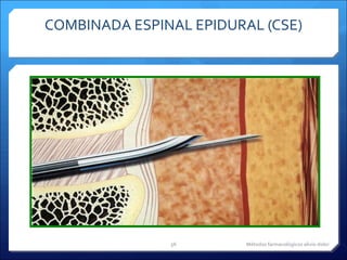 COMBINADA ESPINAL EPIDURAL (CSE) Métodos farmacológicos alivio dolor 