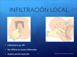 INFILTRACIÓN LOCAL Lidocaína 0.25~2%  No infiltrar en zonas inflamadas Aspirar previa inyección Métodos farmacológicos alivio dolor 