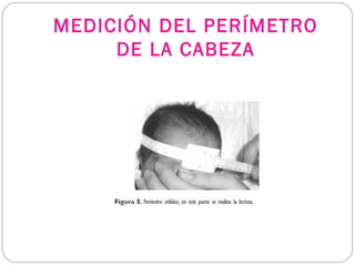 MEDICIÓN DEL PERÍMETRO
DE LA CABEZA
 