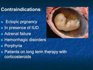 Contraindications:
 Ectopic prgnancy
 In presence of IUD
 Adrenal failure
 Hemorrhagic disorders
 Porphyria
 Patients on long term therapy with
corticosteroids
 