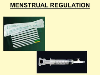 MENSTRUAL REGULATION
 