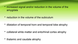 mts[1] the important cause of epilepsy.pptx