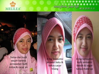 Detox dari kulit
wajah karena
perawatan kulit
kimia & cacar air
8 mg konsumsi
kulit semakin
bersih & segar
tanpa make up
4 mg konsumsi
jerawat batu &
bekas cacar
hilang
 