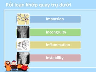 Rối loạn khớp quay trụ dƣới

                Impaction


                Incongruity

                Inflammation


                Instability
 