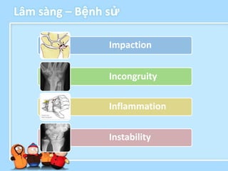 Lâm sàng – Bệnh sử

                Impaction


                Incongruity

                Inflammation


                Instability
 