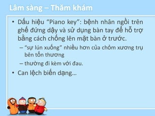 Lâm sàng – Thăm khám
• Dấu hiệu “Piano key”: bệnh nhân ngồi trên
  ghế đứng dậy và sử dụng bàn tay để hỗ trợ
  bằng cách chống lên mặt bàn ở trước.
  – “sự lún xuống” nhiều hơn của chỏm xương trụ
    bên tổn thương
  – thường đi kèm với đau.
• Can lệch biến dạng…
 