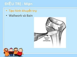 ĐIỀU TRỊ - Mạn
• Tạo hình khuyết trụ
• Wallwork và Bain
 