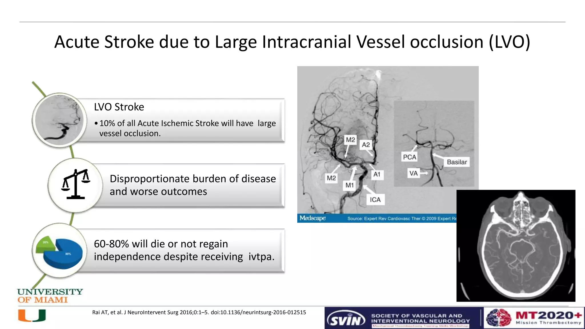 Lvo MT Workshop Patient selection.pptx