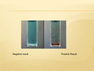 NOTE: To ensure correct reading inspect carefully the presence of small amount of brick red precipitate.Negative result	Positive Result