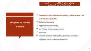 Diagnosis of Fundus
Camera
4
 Fundus imaging helps in diagnosing various ocular and
systemic disorders like
 diabetic retinopathy
 hypertensive retinopathy
 age-related macular degeneration
 glaucoma
 subacute bacterial endocarditis, leukemia, systemic
malignancy with ocular metastasis etc.
‫قسم‬ ‫المالكي‬ ‫عيدان‬ ‫كرار‬.‫م‬
‫المستقبل‬ ‫جامعة‬ / ‫البصريات‬
 