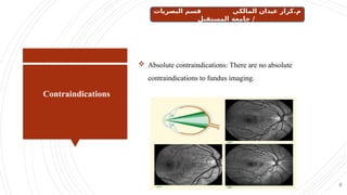 Contraindications
9
 Absolute contraindications: There are no absolute
contraindications to fundus imaging.
‫البصريات‬ ‫قسم‬ ‫المالكي‬ ‫عيدان‬ ‫كرار‬.‫م‬
‫المستقبل‬ ‫جامعة‬ /
 