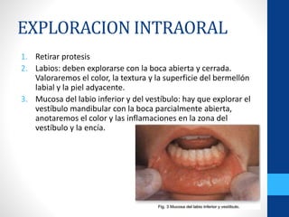 EXPLORACION INTRAORAL
1. Retirar protesis
2. Labios: deben explorarse con la boca abierta y cerrada.
Valoraremos el color, la textura y la superficie del bermellón
labial y la piel adyacente.
3. Mucosa del labio inferior y del vestíbulo: hay que explorar el
vestíbulo mandibular con la boca parcialmente abierta,
anotaremos el color y las inflamaciones en la zona del
vestíbulo y la encía.
 