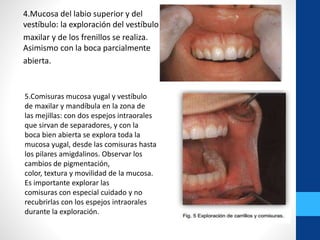 4.Mucosa del labio superior y del
vestíbulo: la exploración del vestíbulo
maxilar y de los frenillos se realiza.
Asimismo con la boca parcialmente
abierta.
5.Comisuras mucosa yugal y vestíbulo
de maxilar y mandíbula en la zona de
las mejillas: con dos espejos intraorales
que sirvan de separadores, y con la
boca bien abierta se explora toda la
mucosa yugal, desde las comisuras hasta
los pilares amigdalinos. Observar los
cambios de pigmentación,
color, textura y movilidad de la mucosa.
Es importante explorar las
comisuras con especial cuidado y no
recubrirlas con los espejos intraorales
durante la exploración.
 